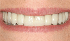 Smile with brighter teeth
