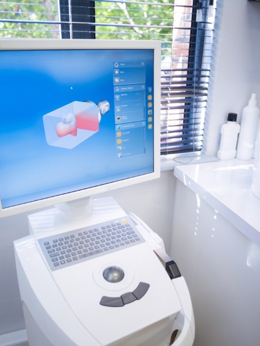 Computer monitor showing model of CEREC one visit dental crown in Rock Hill