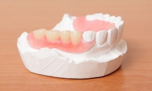 illustration of partial dentures  