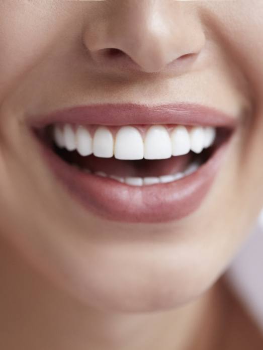 Woman smiling outdoors after periodontal therapy