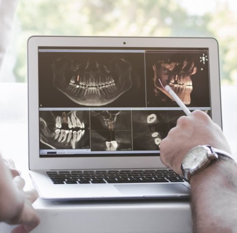 Dentist looking at x rays of teeth on computer