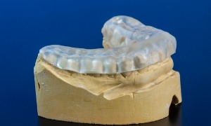 Clear occlusal splint covering model of row of teeth