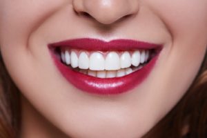 Veneers can brighten your smile.