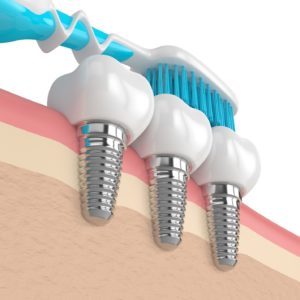 Toothbrush for dental implant aftercare