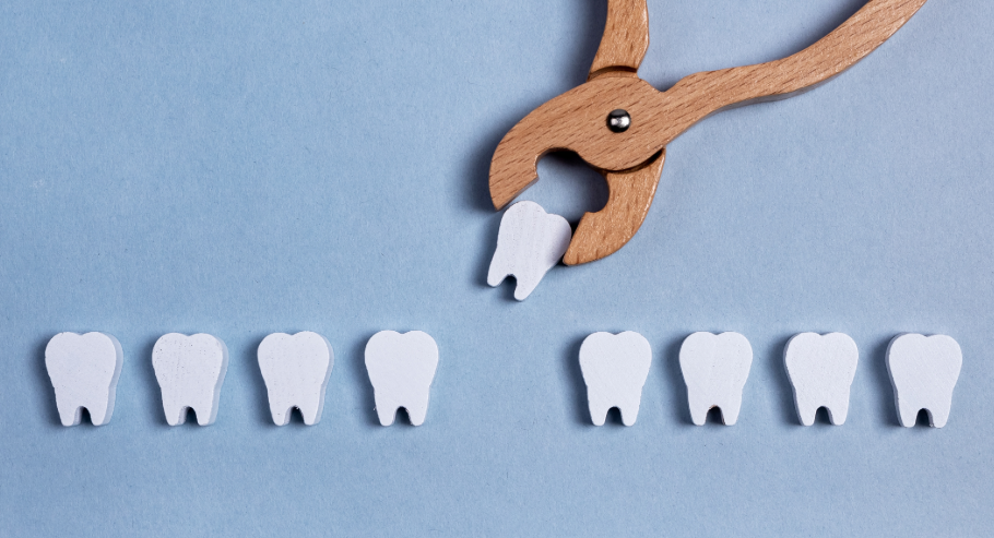 Wooden teeth models with wooden forceps "extracting" a tooth